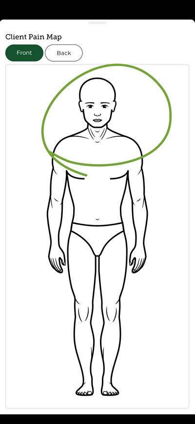 Patient Pain Map